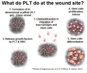 What does PLT do at the wound site?